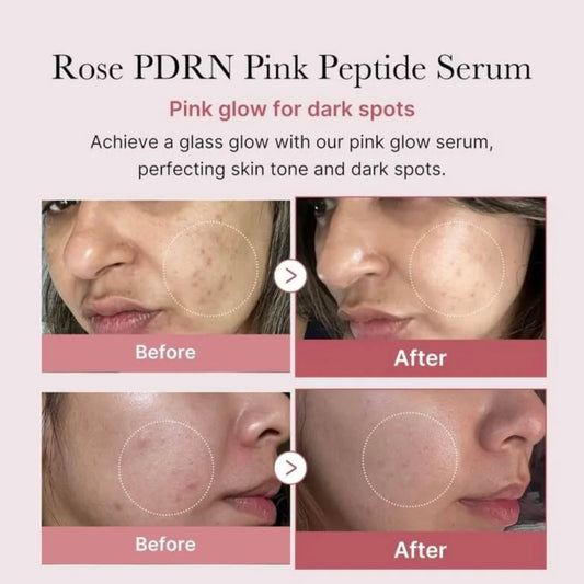 MEDICUBE PDRN PINK PEPTIDE SERUM